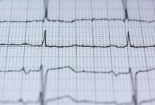 apex wave neural pulse